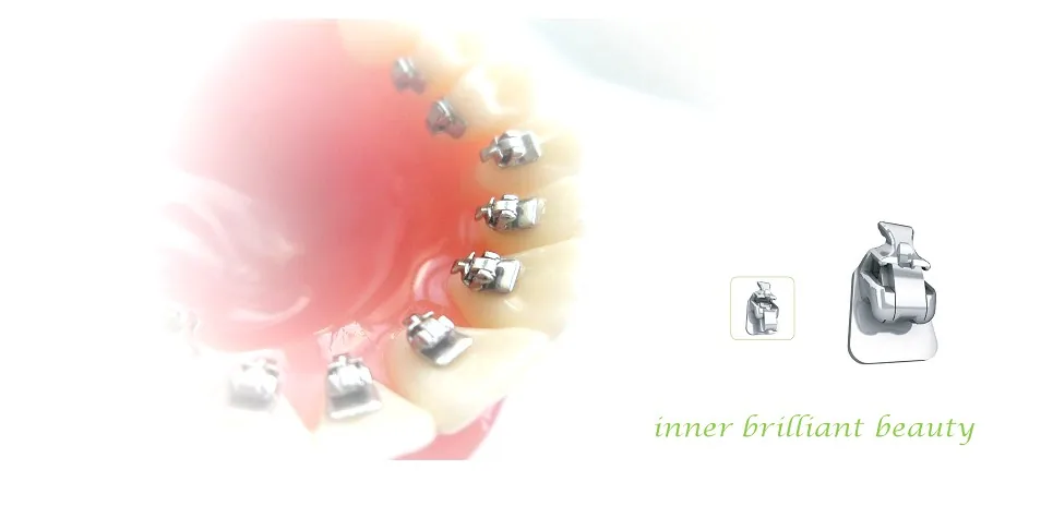 QLingual — image 3